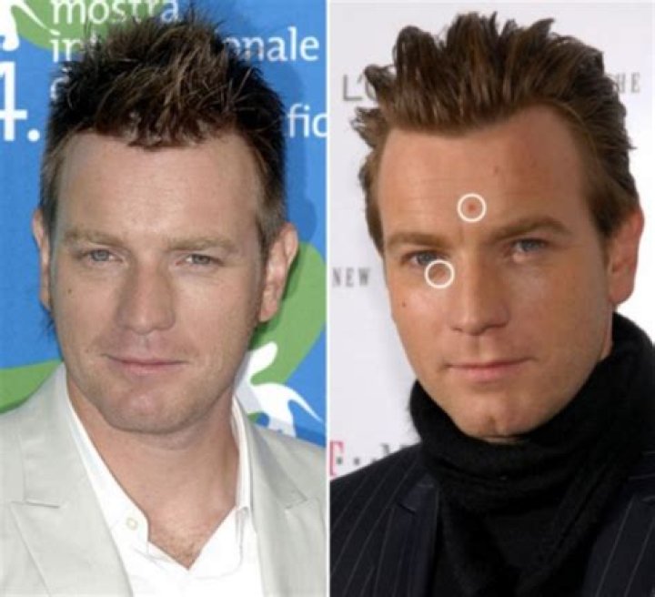 Ewan McGregor Plastic Surgery Before and After